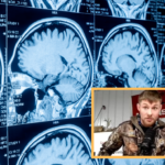 Link Between Brain Damage And Antisemitism Found In UFC Fighter’s Brain